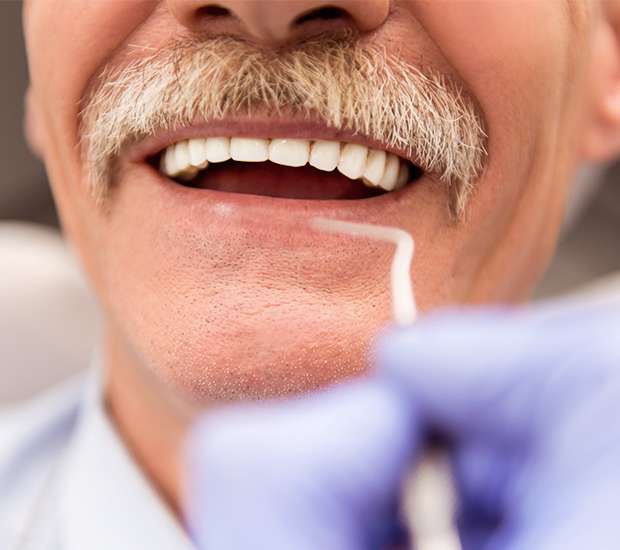 Fair Oaks Adjusting to New Dentures