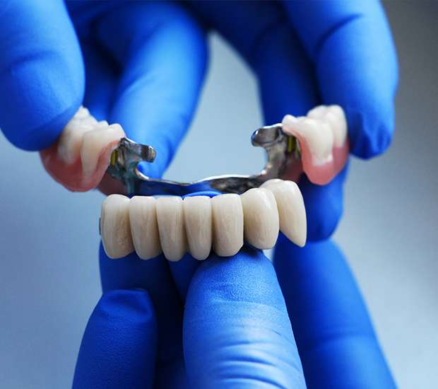 Fair Oaks Dental Bridges