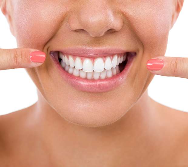 Fair Oaks What Is Gum Contouring & Reshaping
