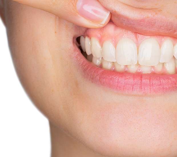 Fair Oaks Gum Disease