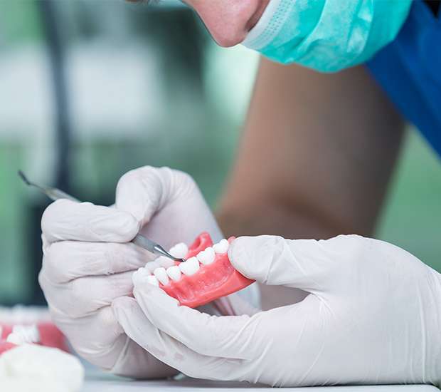 Fair Oaks Partial Denture for One Missing Tooth