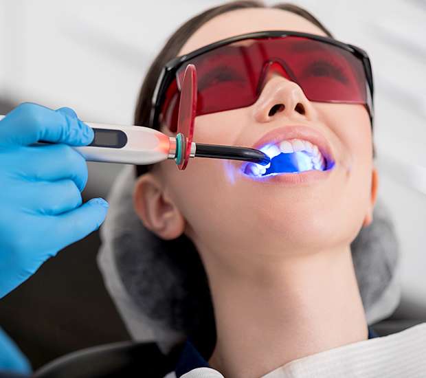 Fair Oaks Professional Teeth Whitening